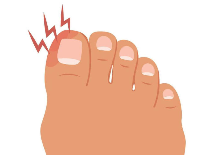Pain in the toe. Pain in the toe.