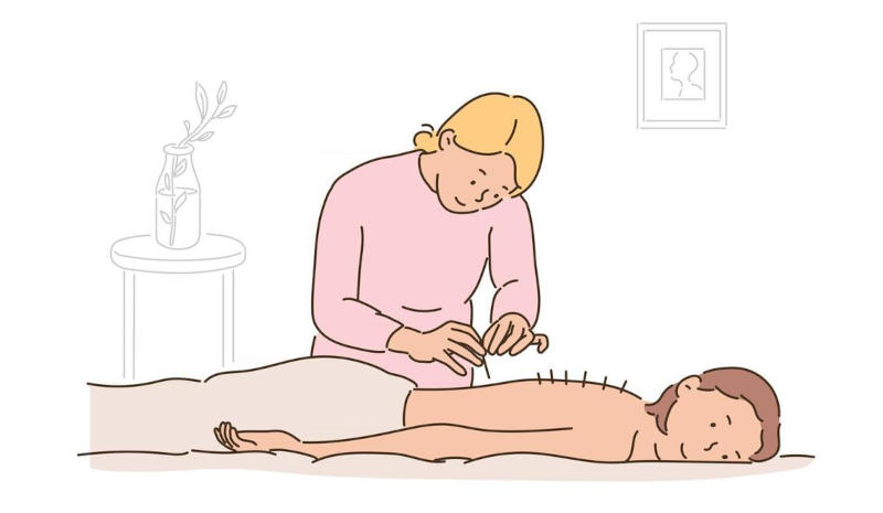trying acupuncture trying acupuncture