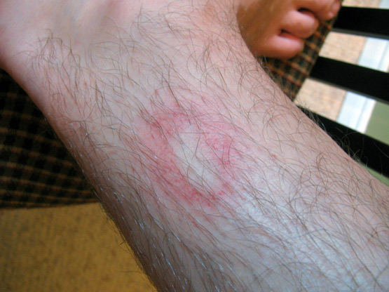 Ouch. Ouch.